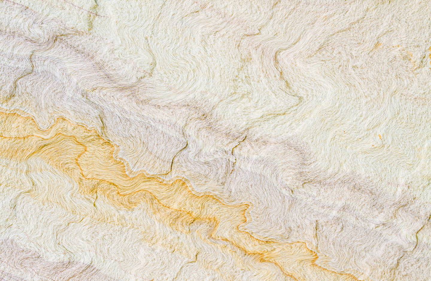 Patient Estimation stone